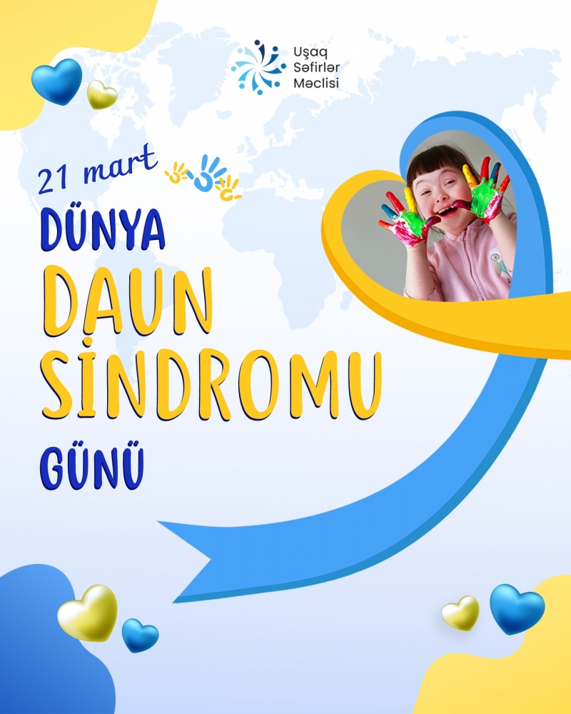 21 Mart - dünyada Beynəlxalq Daun Sindromu Günü